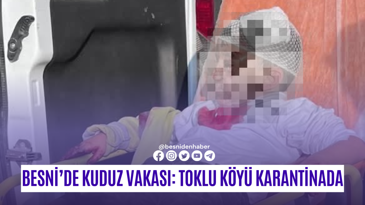 Besni&rsquo;de Kuduz Vakası: Toklu K&ouml;y&uuml; Karantinada